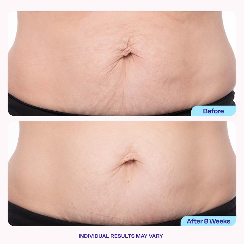 Sculpt Body Contouring Cream